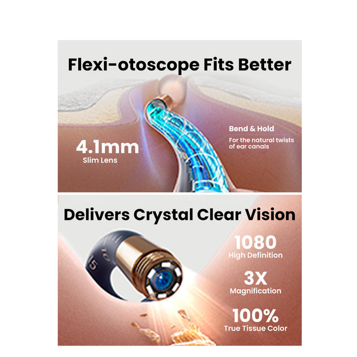 OSelect Bebird Ear Sight Plus I35R Smart Ear Otoscope
