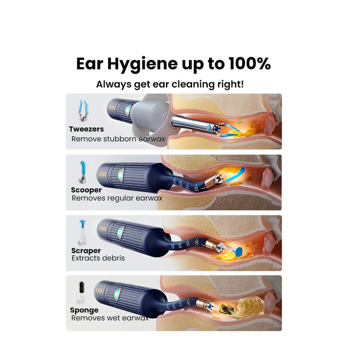 OSelect Bebird Ear Sight Plus I35R Smart Ear Otoscope